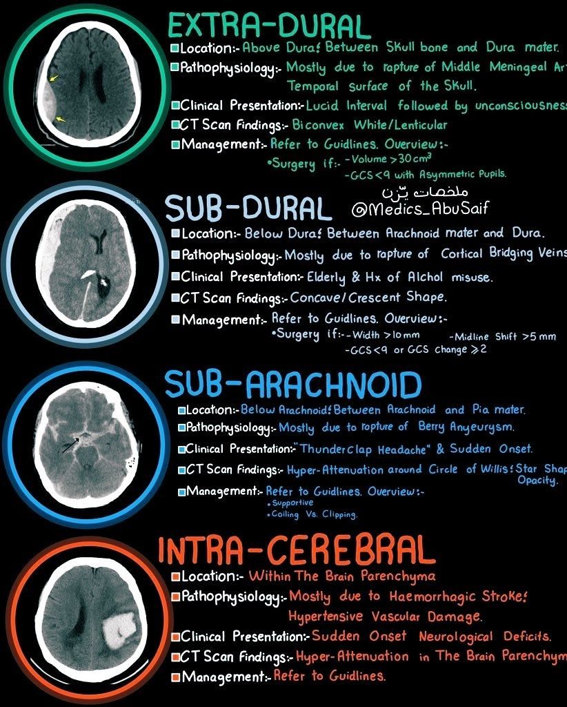 MarlonVFZR's tweet photo. 🧠𝗛𝗲𝗺𝗼𝗿𝗿𝗮𝗴𝗶𝗮𝘀 𝗶𝗻𝘁𝗿𝗮𝗰𝗿𝗮𝗻𝗲𝗮𝗹𝗲𝘀✅
⬇️⬇️⬇️⬇️ 

🔴 1️⃣ 𝙀𝙭𝙩𝙧𝙖-𝙙𝙪𝙧𝙖𝙡 (𝙚𝙥𝙞𝙙𝙪𝙧𝙖𝙡)
📌𝙐𝙗𝙞𝙘𝙖𝙘𝙞𝙤́𝙣: entre el cráneo y la duramadre.
📌𝘾𝙖𝙪𝙨𝙖 𝙩𝙞́𝙥𝙞𝙘𝙖: ruptura de la arteria meníngea media (trauma temporal).
📌𝘾𝙡𝙞́𝙣𝙞𝙘𝙖: intervalo lúcido seguido de deterioro rápido del sensorio.
📌𝙏𝘼𝘾: colección biconvexa o lenticular hiperintensa, que no cruza suturas.
📌𝙈𝙖𝙣𝙚𝙟𝙤:
💥Urgencia neuroquirúrgica.
💥𝙀𝙫𝙖𝙘𝙪𝙖𝙘𝙞𝙤́𝙣 𝙦𝙪𝙞𝙧𝙪́𝙧𝙜𝙞𝙘𝙖 𝙨𝙞 volumen >30 mL o GCS <9 con anisocoria.

🟠 2️⃣ 𝙎𝙪𝙗-𝙙𝙪𝙧𝙖𝙡
📌𝙐𝙗𝙞𝙘𝙖𝙘𝙞𝙤́𝙣: entre duramadre y aracnoides.
📌𝘾𝙖𝙪𝙨𝙖: desgarro de venas puente (frecuente en ancianos o alcohólicos).
📌𝘾𝙡𝙞́𝙣𝙞𝙘𝙖: inicio más progresivo; cefalea, confusión, hemiparesia.
📌𝙏𝘼𝘾: colección concava o en media luna, puede cruzar suturas.
📌𝙈𝙖𝙣𝙚𝙟𝙤:
➡️Cirugía si ancho >10 mm, desviación de línea media >5 mm o deterioro neurológico.

🔵 3️⃣ 𝙎𝙪𝙗𝙖𝙧𝙖𝙘𝙣𝙤𝙞𝙙𝙚𝙖
📌𝙐𝙗𝙞𝙘𝙖𝙘𝙞𝙤́𝙣: entre aracnoides y piamadre.
📌𝘾𝙖𝙪𝙨𝙖: rotura de aneurisma sacular (de Berry).
📌𝘾𝙡𝙞́𝙣𝙞𝙘𝙖: 𝙘𝙚𝙛𝙖𝙡𝙚𝙖 𝙚𝙣 𝙩𝙧𝙪𝙚𝙣𝙤 (“worst headache of life”), rigidez de nuca, pérdida de conciencia.
📌𝙏𝘼𝘾: hiperdensidad en cisternas basales o alrededor del polígono de Willis.
📌𝙈𝙖𝙣𝙚𝙟𝙤:
➡️Soporte intensivo + control PA.
➡️𝘿𝙚𝙛𝙞𝙣𝙞𝙩𝙞𝙫𝙤: clipado o coiling endovascular del aneurisma.

🟣 4️⃣ 𝙄𝙣𝙩𝙧𝙖-𝙘𝙚𝙧𝙚𝙗𝙧𝙖𝙡
📌𝙐𝙗𝙞𝙘𝙖𝙘𝙞𝙤́𝙣: dentro del parénquima cerebral.
📌𝘾𝙖𝙪𝙨𝙖: crisis hipertensiva o angiopatía amiloide.
📌𝘾𝙡𝙞́𝙣𝙞𝙘𝙖: déficit neurológico focal de inicio súbito, cefalea, vómito.
📌𝙏𝘼𝘾: área hiperdensa en el parénquima, rodeada de edema.
📌𝙈𝙖𝙣𝙚𝙟𝙤:
➡️Control PA y PIC.
➡️Evacuar hematoma si grande o con efecto de masa significativo.

👇🏼👇🏼👇🏼👇🏼
📚📖#ClubCrit

#ACVHemorragico #HIC #MedTwitter #CritCare #UCI #ICU #CriticalCare #Diagnóstico #icu #intensivecare #MedTwitter #diagnosis #management #Riesgo #ICU #POCUS #UCI #Tratamiento #MedicinaBasadaEnEvidencia #Emergencia #Terapia #MedEd #Medicina #Emergencias #FOAMed #FOAMcc #MedTwitter #CriticalCare #MedEd #CuidadoCrítico #MedX #IntensiveCare #EducaciónMédica #MedIntensiva #MedXCommunity #MedicinaCrítica #MedED #CritCare #ICUManagement #MustRead #LecturaRecomendada