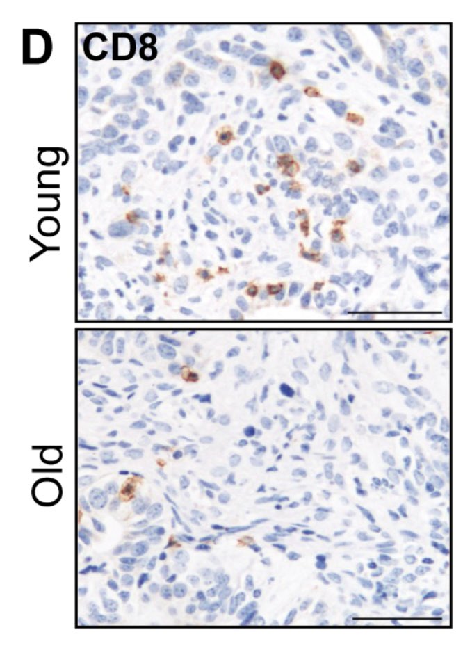 Aiims1742's tweet image. New @CR_AACR study by @Cosimo_Commisso 
The Aging Microenvironment is a Determinant of Immune Exclusion and Metastatic Fate in #PancreaticCancer
aacrjournals.org/cancerres/arti…