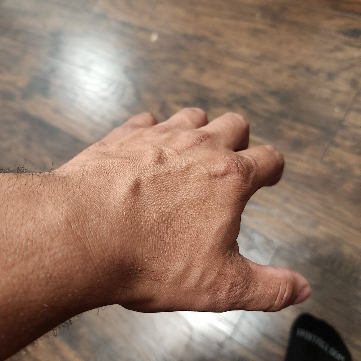 KIClood's tweet photo. I heard you like vascularity? https://t.co/XRq0VMicTI