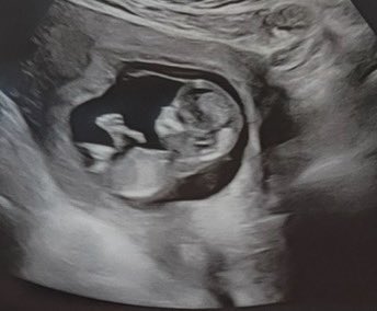 Most people don’t know this but I didn’t start JellyGoat for me, it was always for the legacy

Something for my kids and eventually grandkids to take over

2026 will bring a new heir! I’m gonna be a GoatPa &amp; so unbelievably excited

GOAT things come in SMOL form

Coming soon…