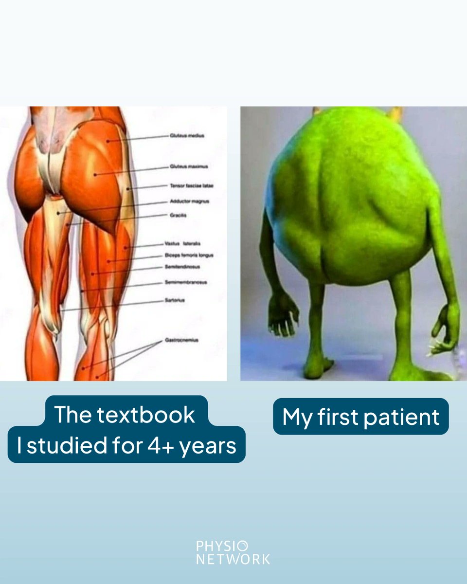 PhysioNetwork's tweet image. Textbook anatomy: neat, symmetrical, beautiful.
Real patients: chaos, mystery, and mild panic. 😅