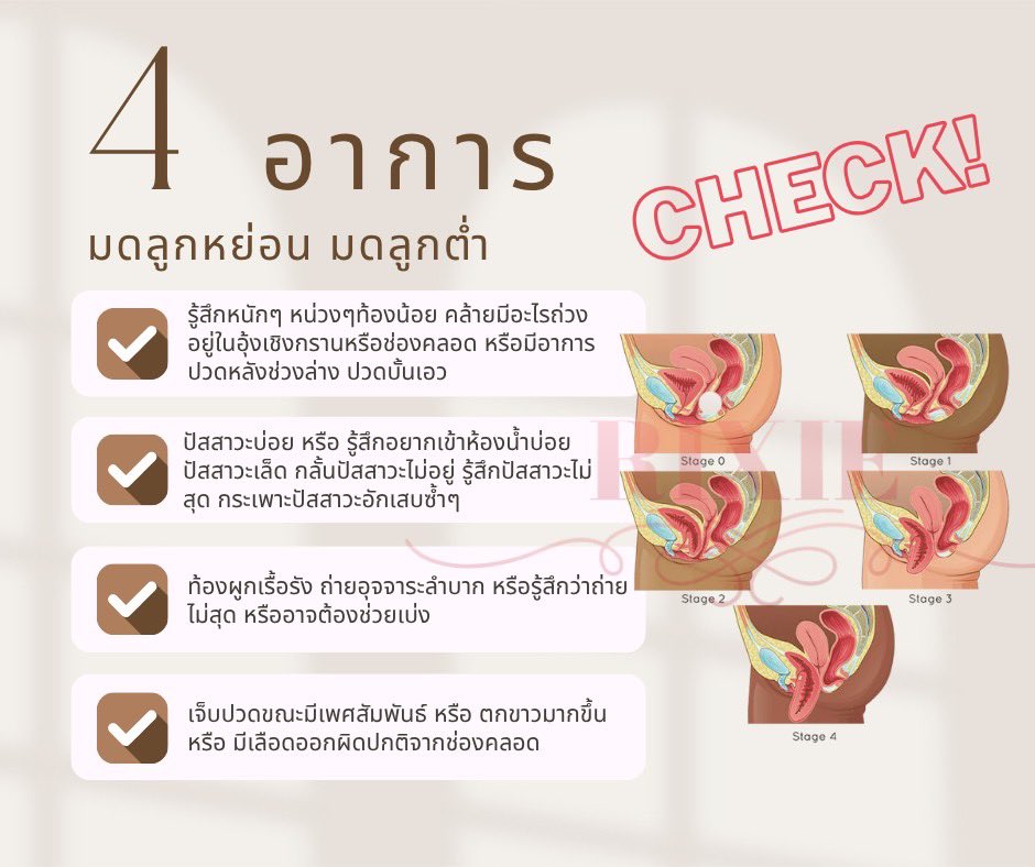 rixiewomen's tweet photo. 👉🏻คุณกำลังเจอปัญหาเหล่านี้อยู่หรือป่าว?
👉🏻เชค! 4 ��าการ... มดลูกหย่อน มดลูกต่ำ

📍หน่วงๆท้องน้อย เหมือนอะไรจะหลุดออกมา ปวดหลังปวดเอว
📍ฉี่บ่อย เห็นห้องน้ำไม่ได้เลย ฉี่เล็ด เหมือนฉี่ไม่สุด
📍ขับถ่ายยาก ท้องผูกเรื้อรัง
📍เจ็บเวลามีเพศสัมพันธ์

#มดลูกหย่อน #rixie #ริกซี่ #มดลูกต่ำ https://t.co/k8MLYwowLq