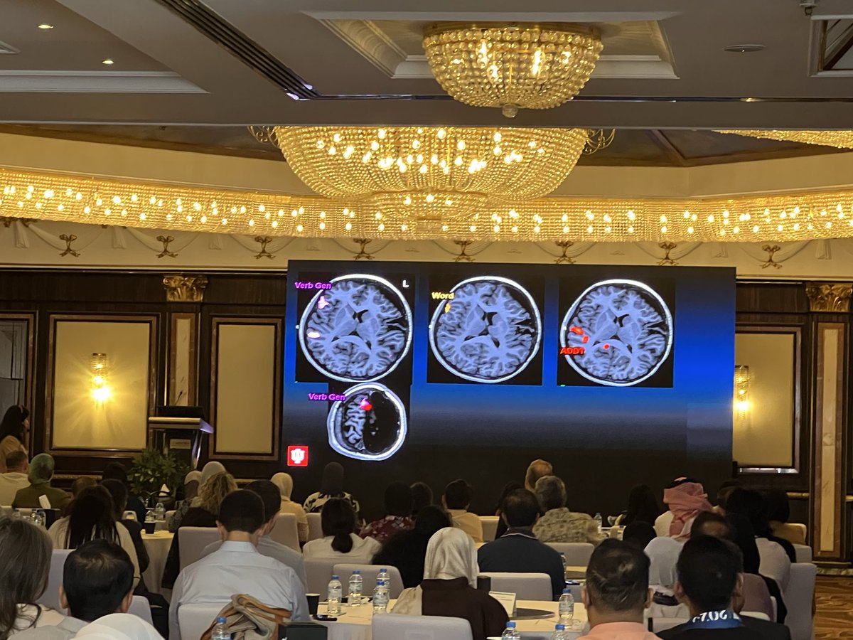 The_ASPNR's tweet image. Dr @RadRupa showing interesting #fMRI cases @spinacademics #pedineurorad #neurorad