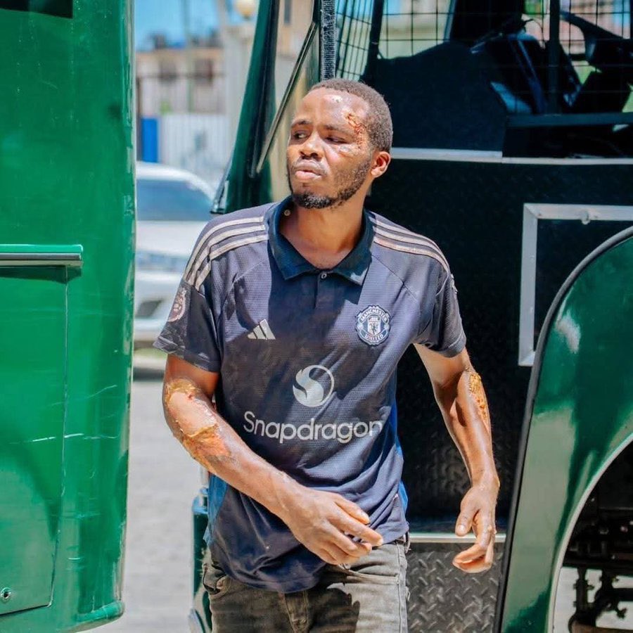 Hii sio suluhu Bali ni kuchochea hasira na chuki zitakazozalisha machafuko unawezaje kumchoma mwanadam na pasi Kama njia ya kushinikiza dhulma. Muda utatoa majibu.