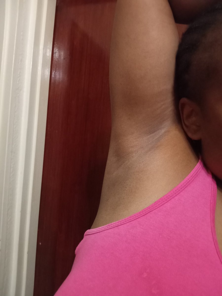 I didn't believe it when they said the roll on is so good for dark pits. I am so in love!