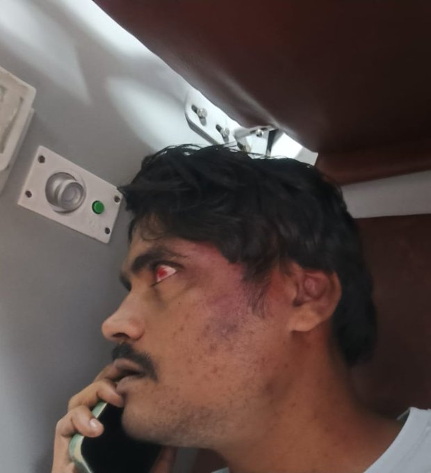 यूपी में एक पत्रकार पर शराब माफियाओं ने जानलेवा हमला किया.

पत्रकार <a href="/ShubhamKlive/">Shubham Srivastava</a> दैनिक भास्कर से जुड़े हैं और वे कवरेज के लिए गए थे. 

आप सोचिए ये कितना खतरनाक है. जिस प्रदेश के मुखिया कहते हैं- राज्य से अपराधी पलायन कर गए, वहां एक पत्रकार सुरक्षित नहीं है.