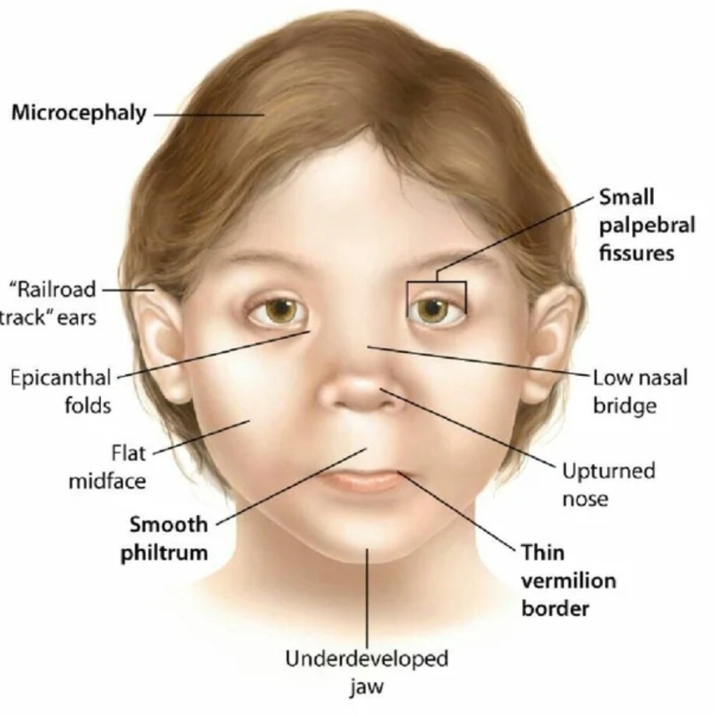 LessScotchy's tweet image. is this the first fursuit with fetal alcohol syndrome?