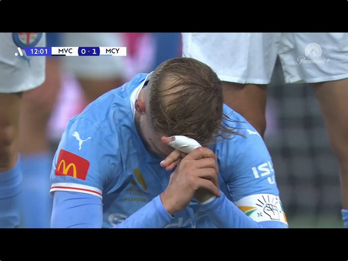 RunThemMemes's tweet image. Thurgate levels …  #MelbDerby