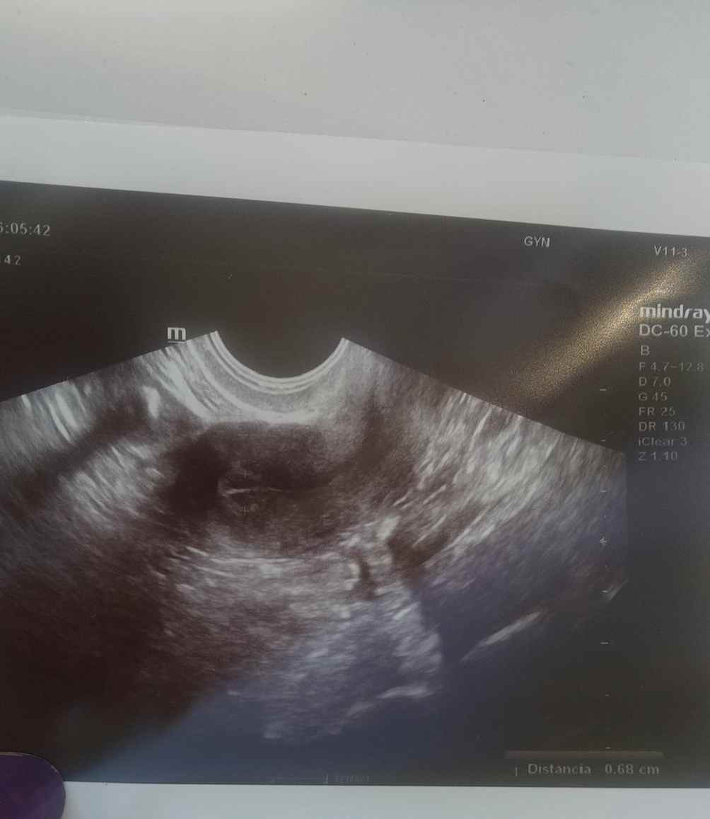 MetaMounts42's tweet image. また新しいチャンスが来るよ。 🐝👘