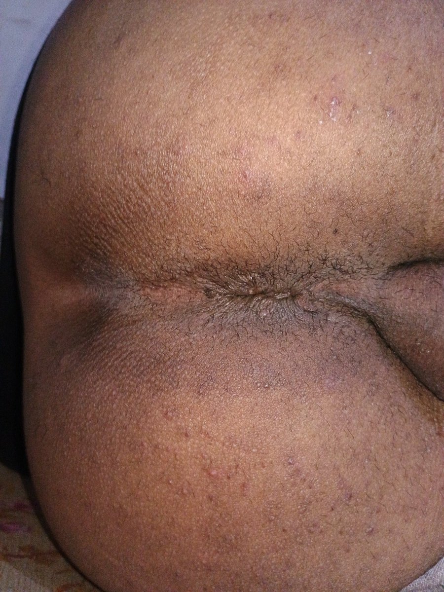 احا بحب اتناك بالوضع ده اوى 🥒🥒🥒