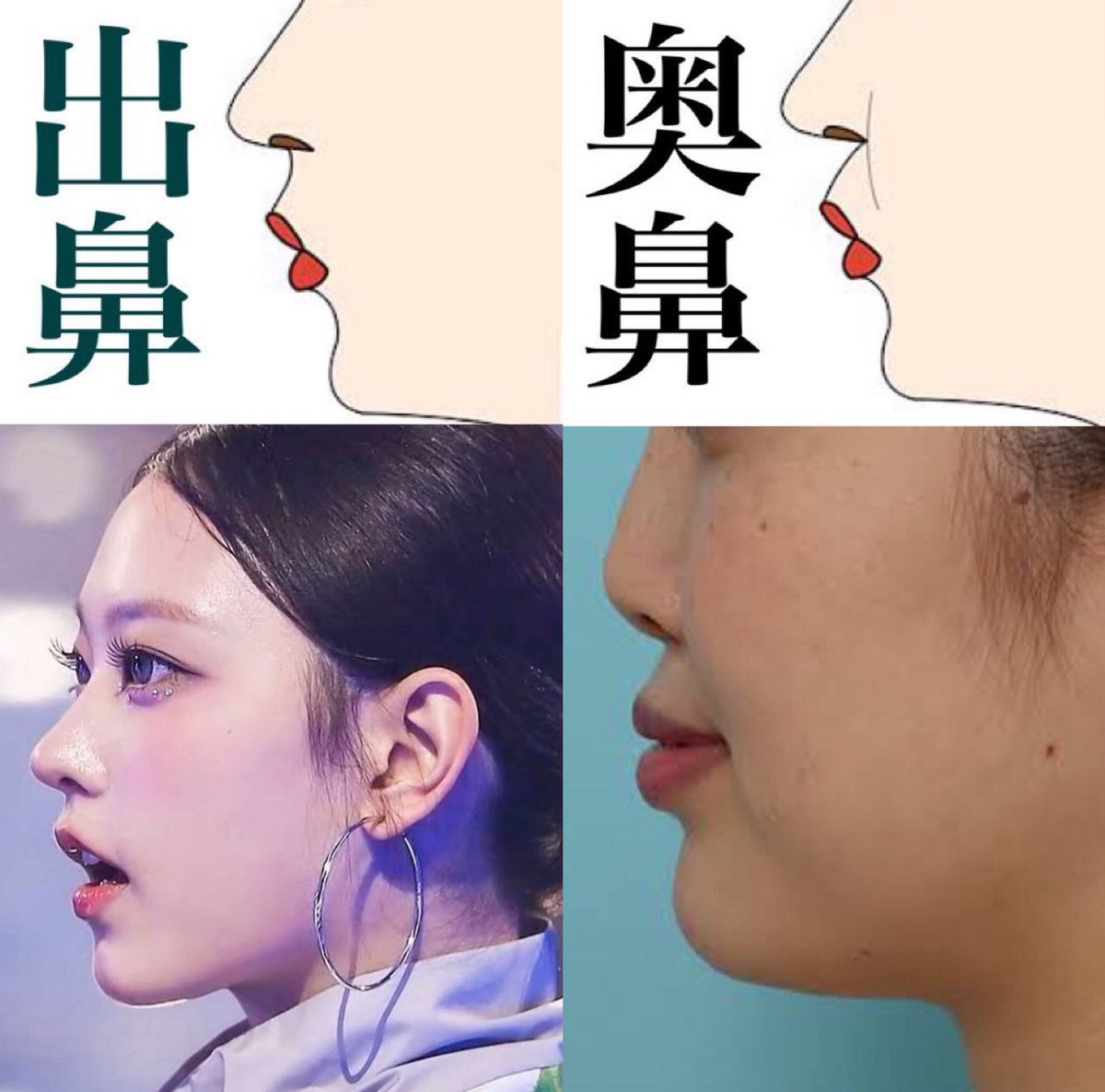 指原 整形(02)