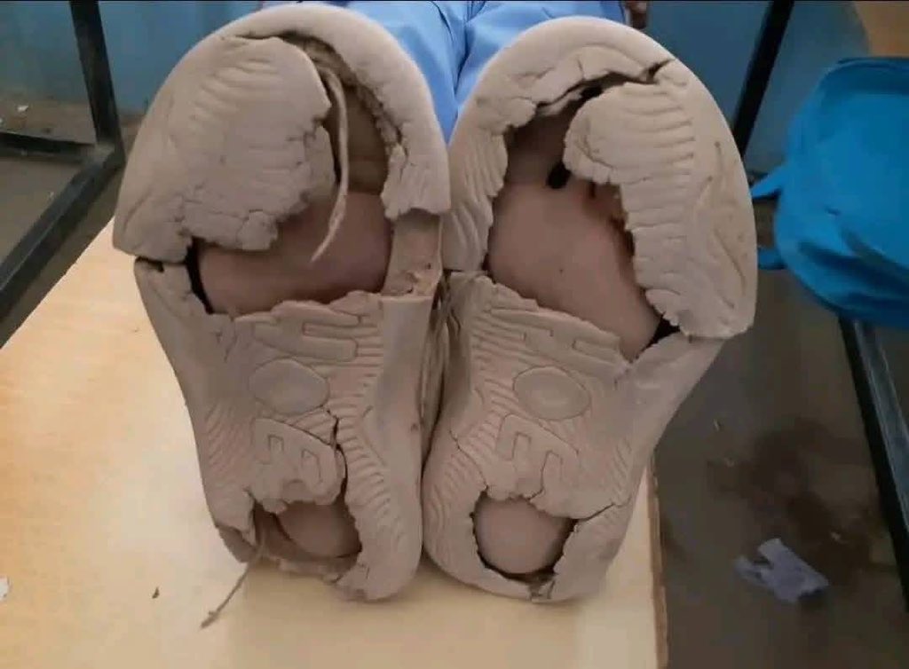 Afghanistan’s reality in one line: 85% live in poverty, 3.5 million children face acute malnutrition, and 90% of kids under two suffer food poverty. No growth, no jobs, no stability — just survival. A nation starved not only of food, but of opportunity. #Afghanistan #Hunger