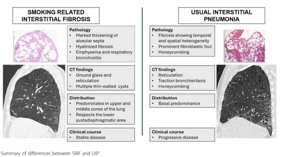 📍Esquema comparativo entre SRIF y NIU