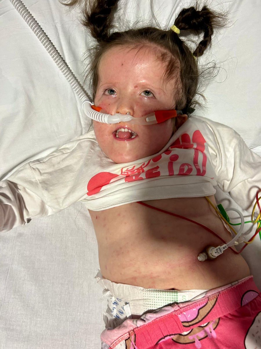 wolvespremier's tweet image. Finally SMILES 

This WARRIOR knows no bounds!

Thank you for the countless messages it has really helped the journey.

My wife sees all of the messages and it gives so much strength so never underestimate the kindness in our hearts!

Olivia is now one step away from coming off…