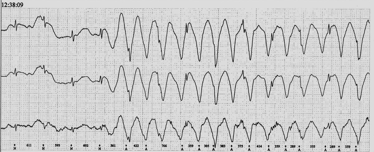 Dr. Andreas Roeschl tweet media