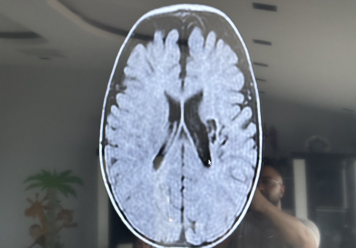 Polatmania tweet media