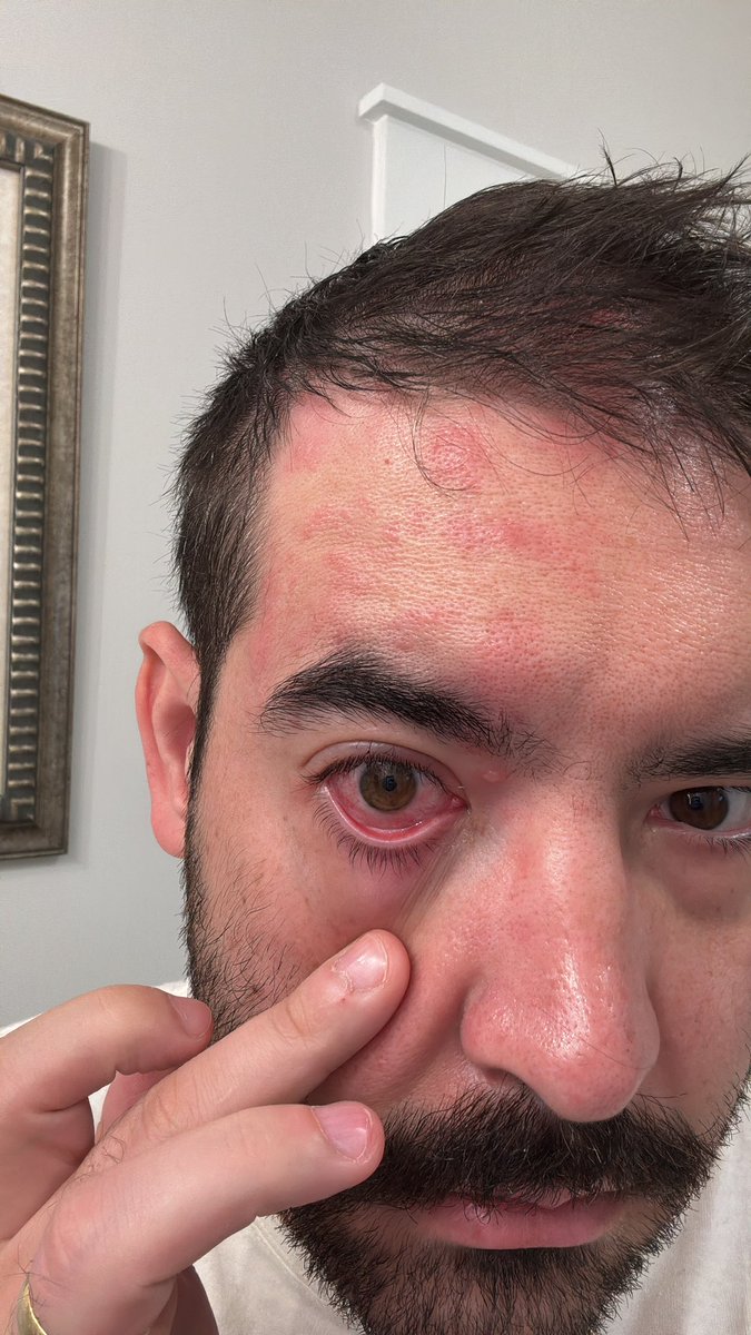 yosoykush tweet media