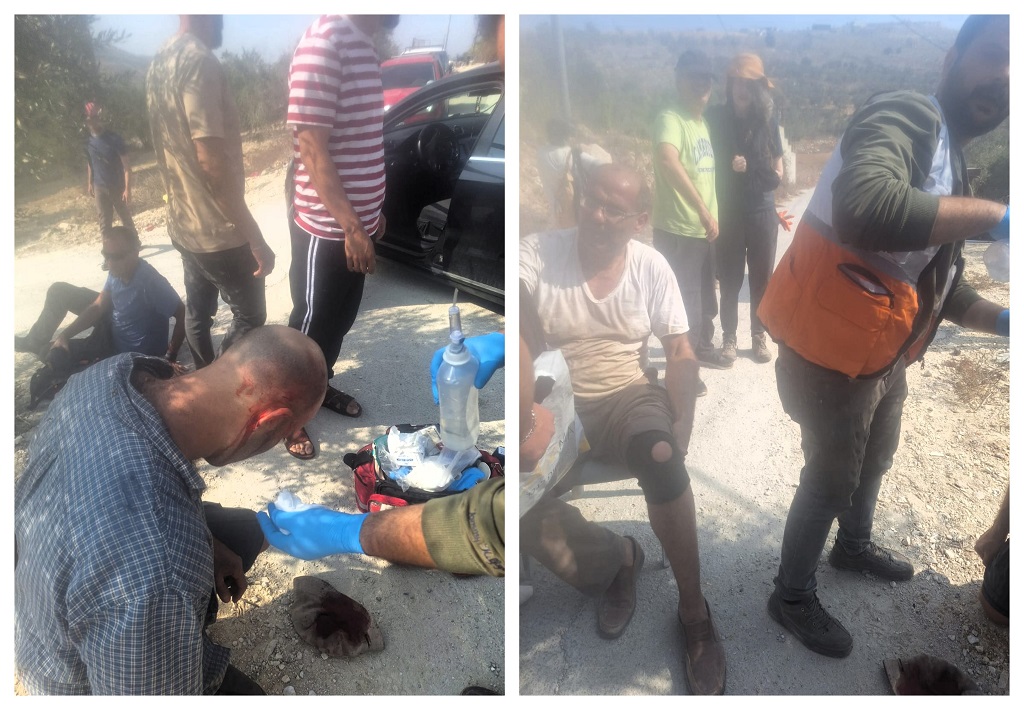 West Bank - A Palestinian citizen &amp; four international activists were injured today, Saturday, following an assault by Israeli settlers in the village of Burin.
Israeli settlers attacked Palestinian civilians and several foreign activists while they were harvesting olives.
