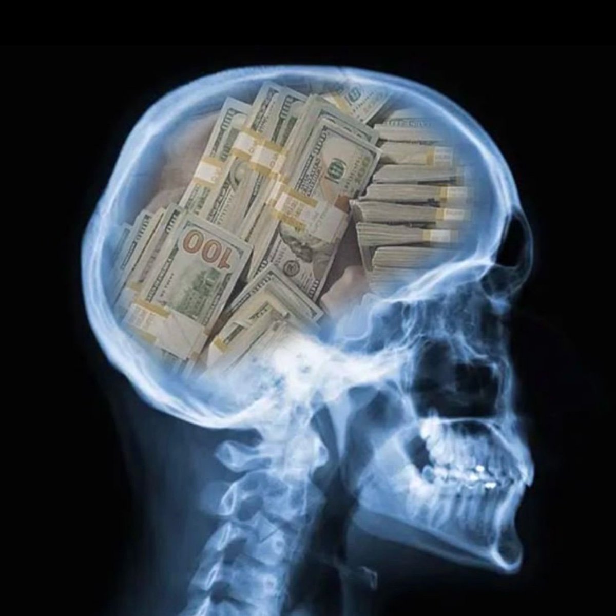 purpose6345's tweet image. Doctor ran a brain scan, said I’m perfectly healthy  just got money on my mind 24/7 💸🧠, This is what focus looks like in 2025, Think rich,Act rich., Become rich, Don’t try to understand me, we think in different currencies 😤💰 #Mindset #MoneyOnMyMind #BossVibes&quot;*