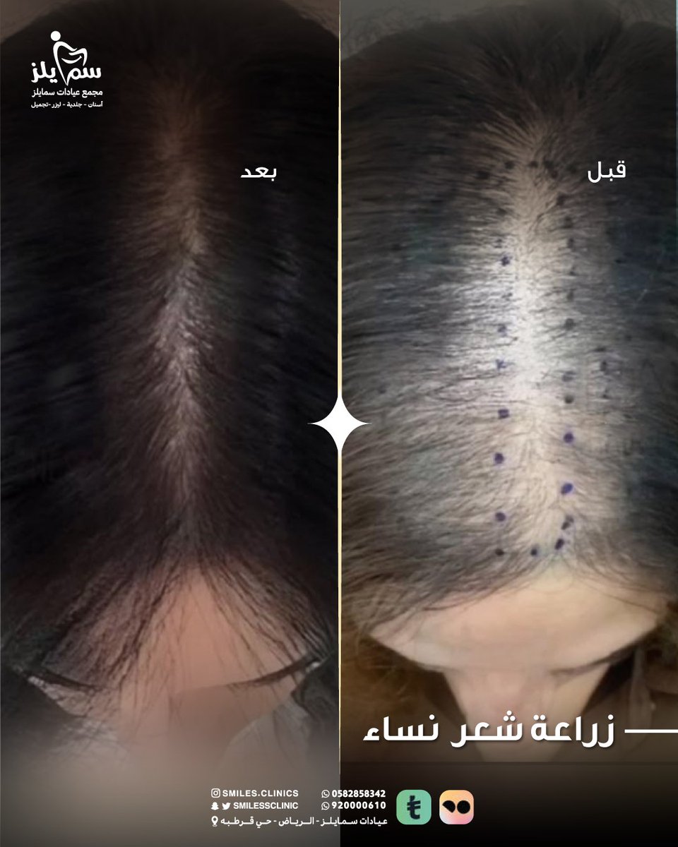 عيادات سمايلز smilesclinic (@smilessclinic) on Twitter photo 