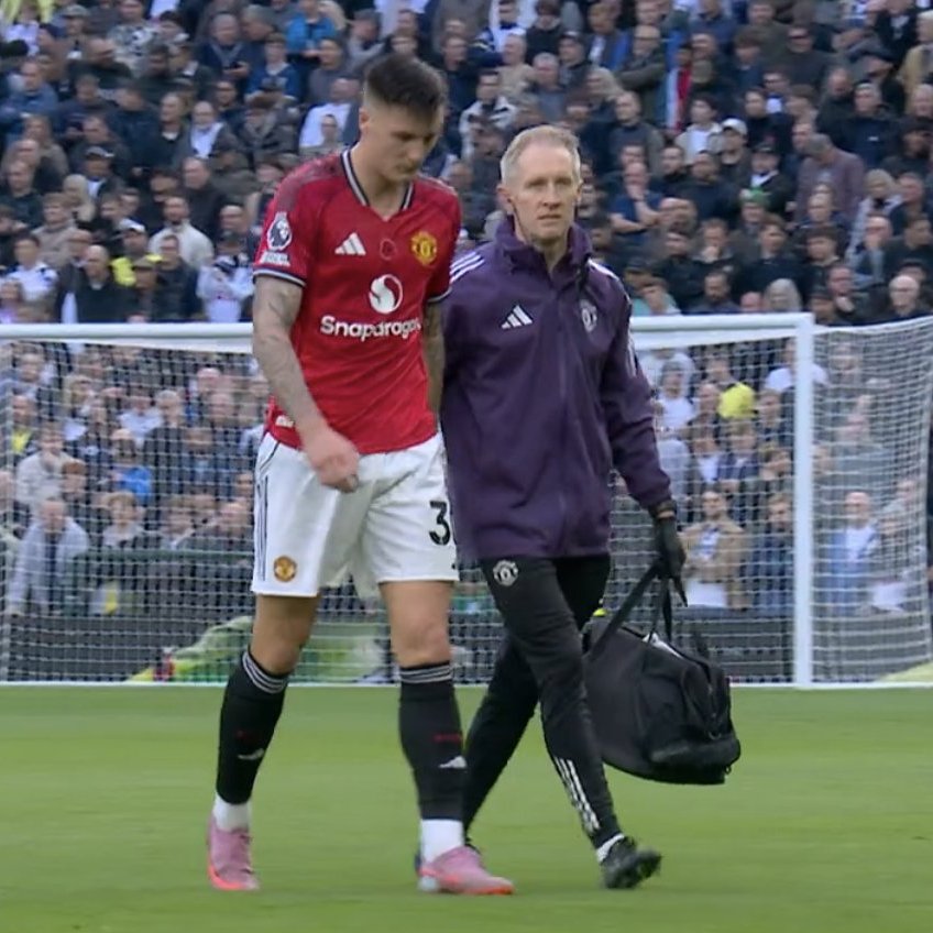 nuradeeeen's tweet image. Even my grandma is faster than Sesko.