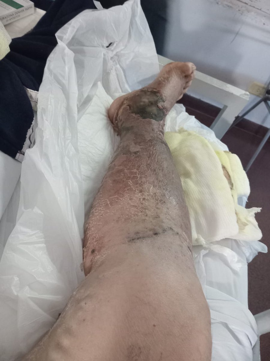 silviygonz's tweet photo. @JMilei Vive sacando préstamos, hace más de un año se cura la pierna por una enfermedad que tuvo, le sacaron la internacion domiciliaria y nosotros no lo podemos ayudar tampoco, no soy K, y estoy pagando por el.odio que les tiene, nones un buen pres, es un pres solo para algunos https://t.co/UbPZHSEdaR
