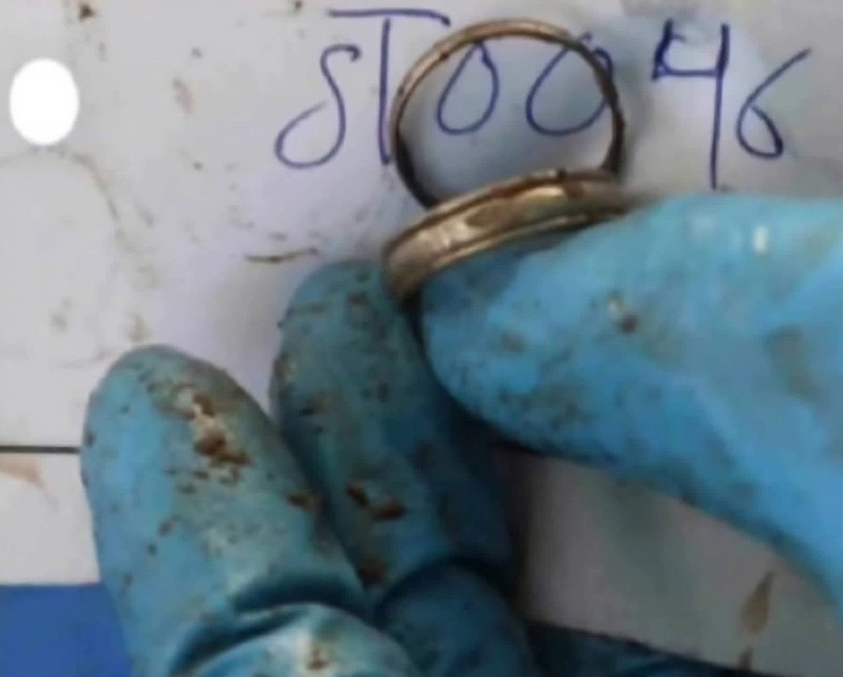 A Palestinian woman could only identify her husband's mutilated body by his wedding ring, after Israeli regime forces returned the corpses of slain Palestinians they had been withholding. The bodies were so severely tortured that they were rendered unrecognizable.
#GazaHolocaust