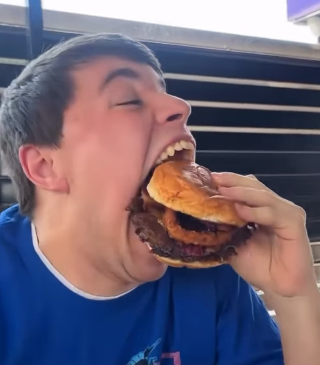 pubity's tweet image. A Minnesota teen has broken the world record for largest jaw gape at 10cm.