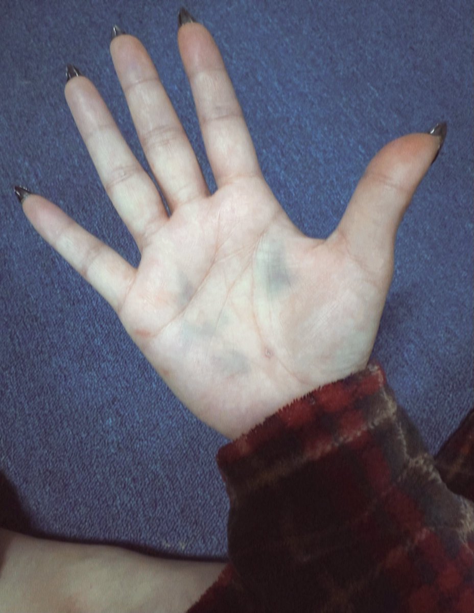 Patternp5N_u's tweet image. am 05:00