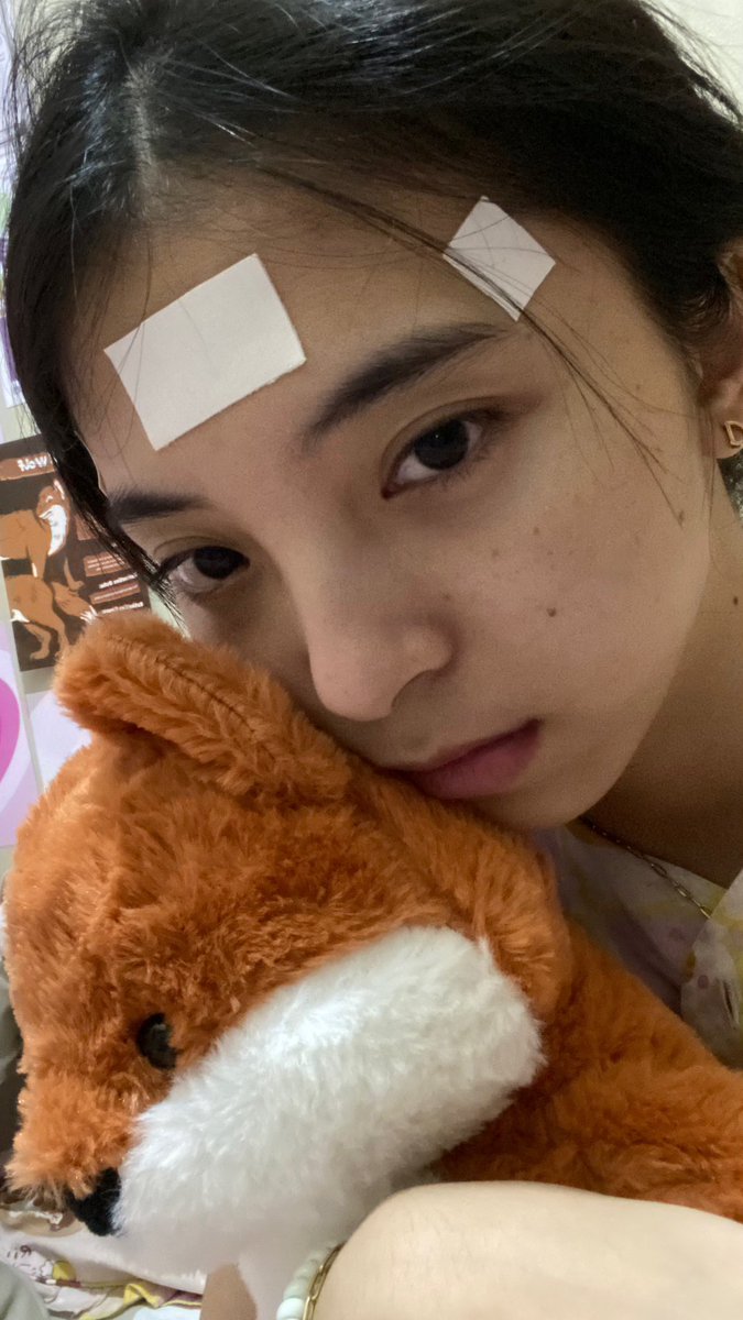 before🥰                      after🥴