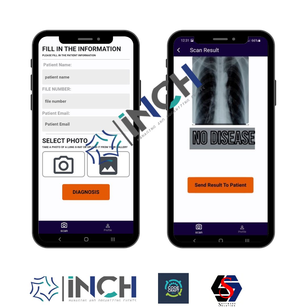 Inch_Coding's tweet image. #مشروع_تخرج تحليل صورة الاشعة السينية لاكتشاف أمراض الرئة عن طريقة #الذكاء_الاصطناعي باستخدام #CNN #Yolo  هذه التقنية اللتي أعدت خصيصا للكشف عن الكائنات في الصور باستخدام #التعلم_العميق
الهدف توفير تشخيص دقيق وفعال للالتهاب الرئوي.
#المملكة
Wa.me/971565991072