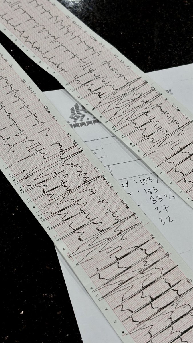 lethalpropofol's tweet image. Opening jaga malam pertama dan opening jaga malam kedua, padahal lagi gak jaga bareng Ica dan Kurfit 😌