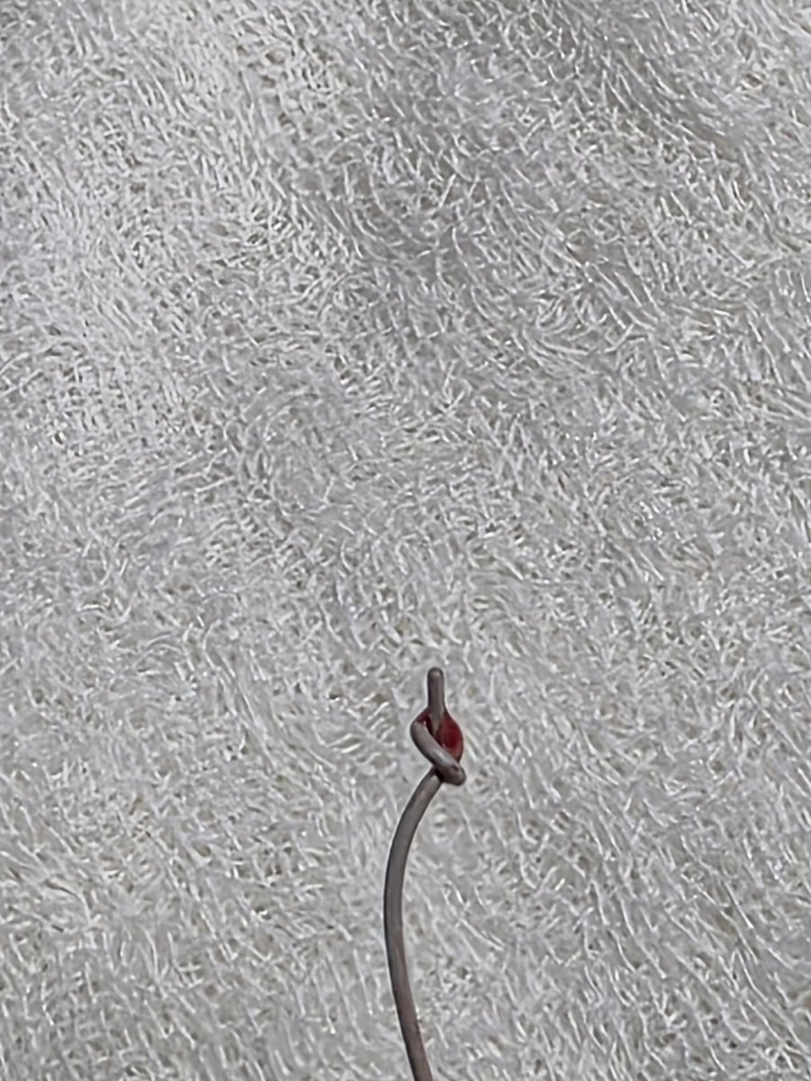 urotelio's tweet photo. Nudo 🪢 en la punta distal de la guía 

Me han pasado muchas cosas en mis casos de #MiniPCNL pero algo así no me había pasado nunca 😅

@urobraulio @RomanCarvajal @felipeglezglez @Endo_Society https://t.co/mKoZbuXeXg