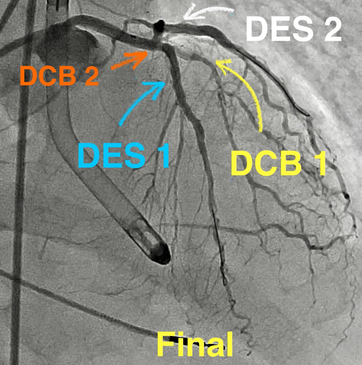 Salman Arain tweet media