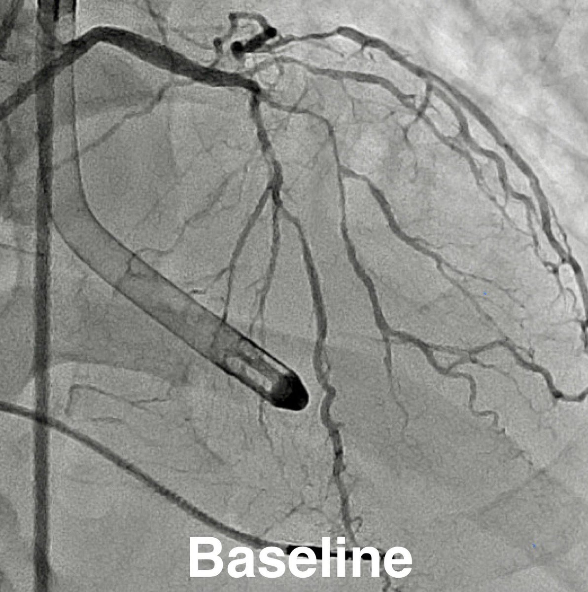 Salman Arain tweet media