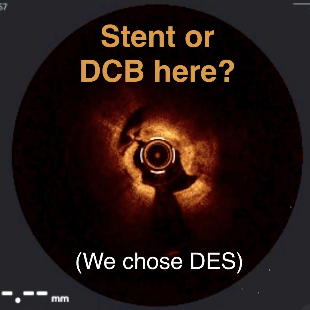 Salman Arain tweet media