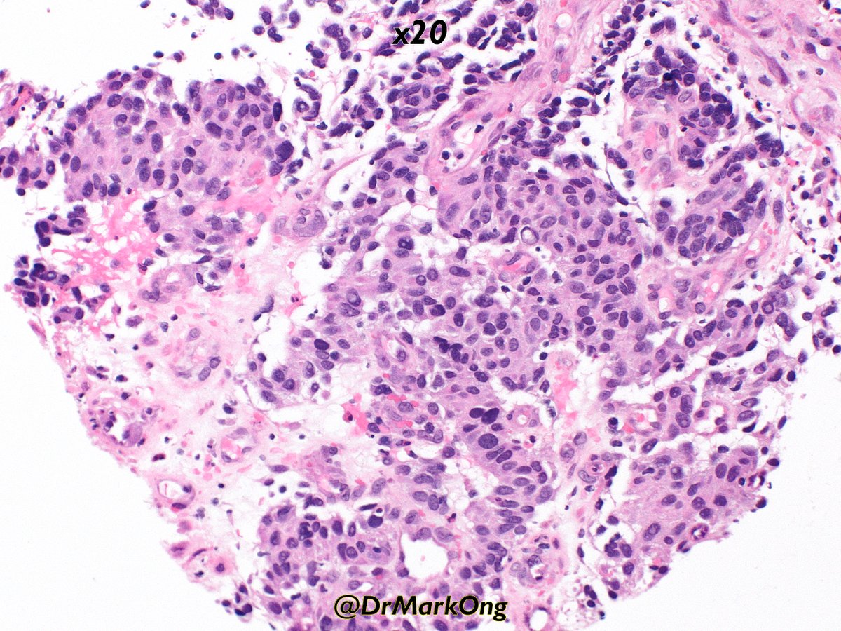 Mark Ong tweet media