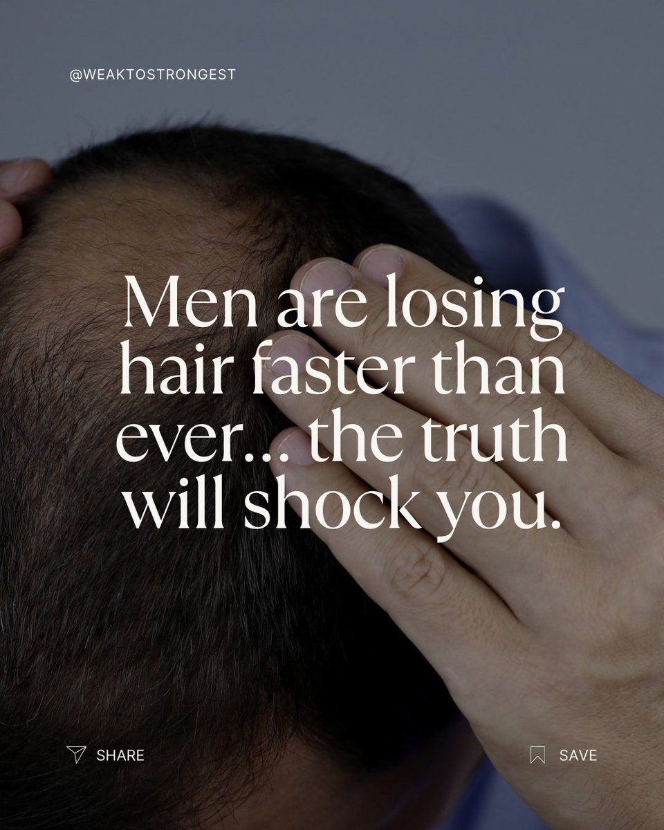 EssenAmanda's tweet image. Hair loss isn’t genetics. It’s your hormones, mitochondria, and stress levels failing. A transplant won’t fix it. Rebuild your system, restore energy, confidence, and hair. DM “REBUILD” or grab my eBook here: buy.stripe.com/3cs15o02L6s2gK…

#Biohacking #MensHealth #HairLoss