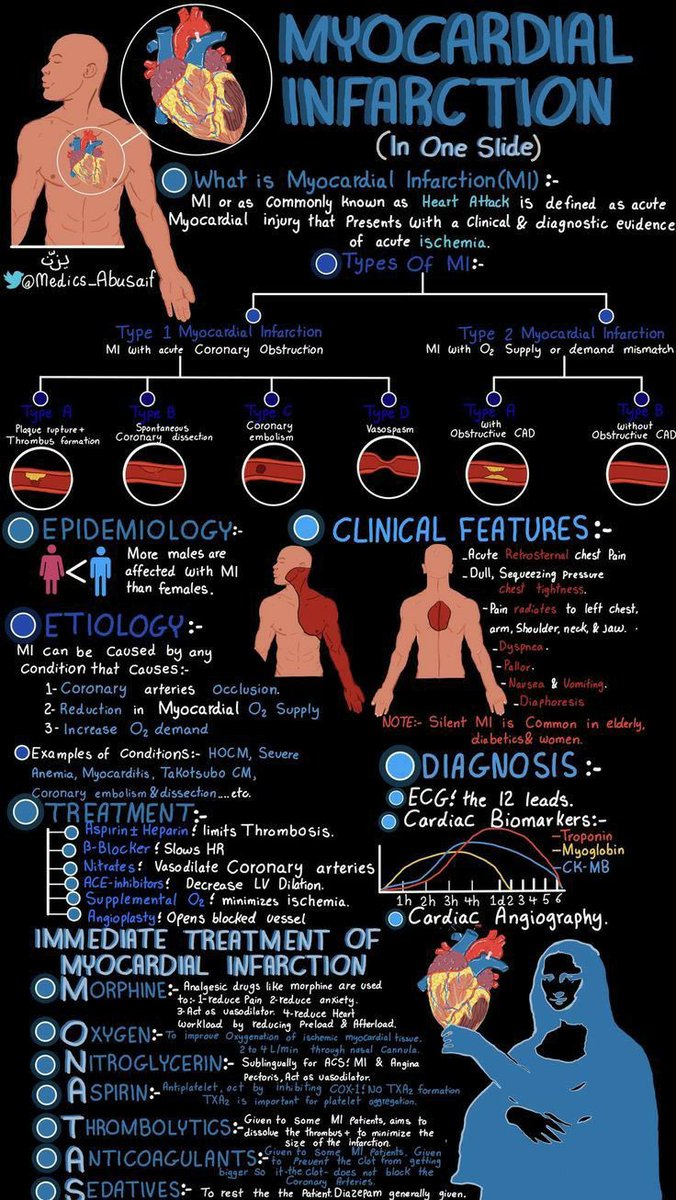 MYOCARDIAL INFARCTION Excellent infographic 😍
Adapted from: <a href="/medics_AbuSaif/">يـزّن الغماس</a>