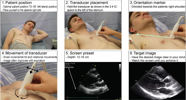 pocus_today's tweet photo. Reference: USABCD: 
https://t.co/hsr0T3nkwG
#useit #POCUS https://t.co/NxESHgQWa2