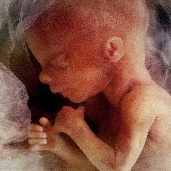 You can know the heart of people by their treatment of unborn children.