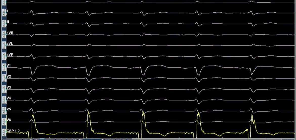 Roderick Tung tweet media