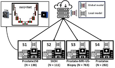 Radiology_AI's tweet image. Optimizing Federated Learning Configurations for MRI Prostate Segmentation and Cancer Detection: A Simulation Study doi.org/10.1148/ryai.2… @radboudumc @NKI_nl #prostate #FederatedLearning #AI
