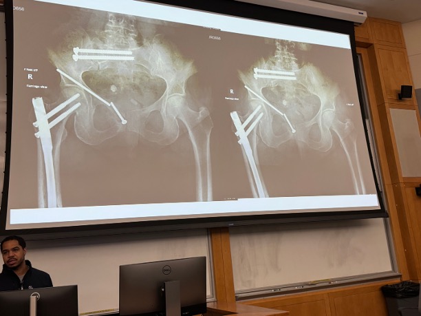 abdelbarrspine's tweet image. Saturday morning spent teaching #neurosurgery and #orthopedic residents, fellows about lateral approaches to the spine and with my friend and colleague Dr.  Malcolm R. DeBaun,  multi-disciplinary care of pelvic and sacral fractures. Also got to spend some time in the lab.