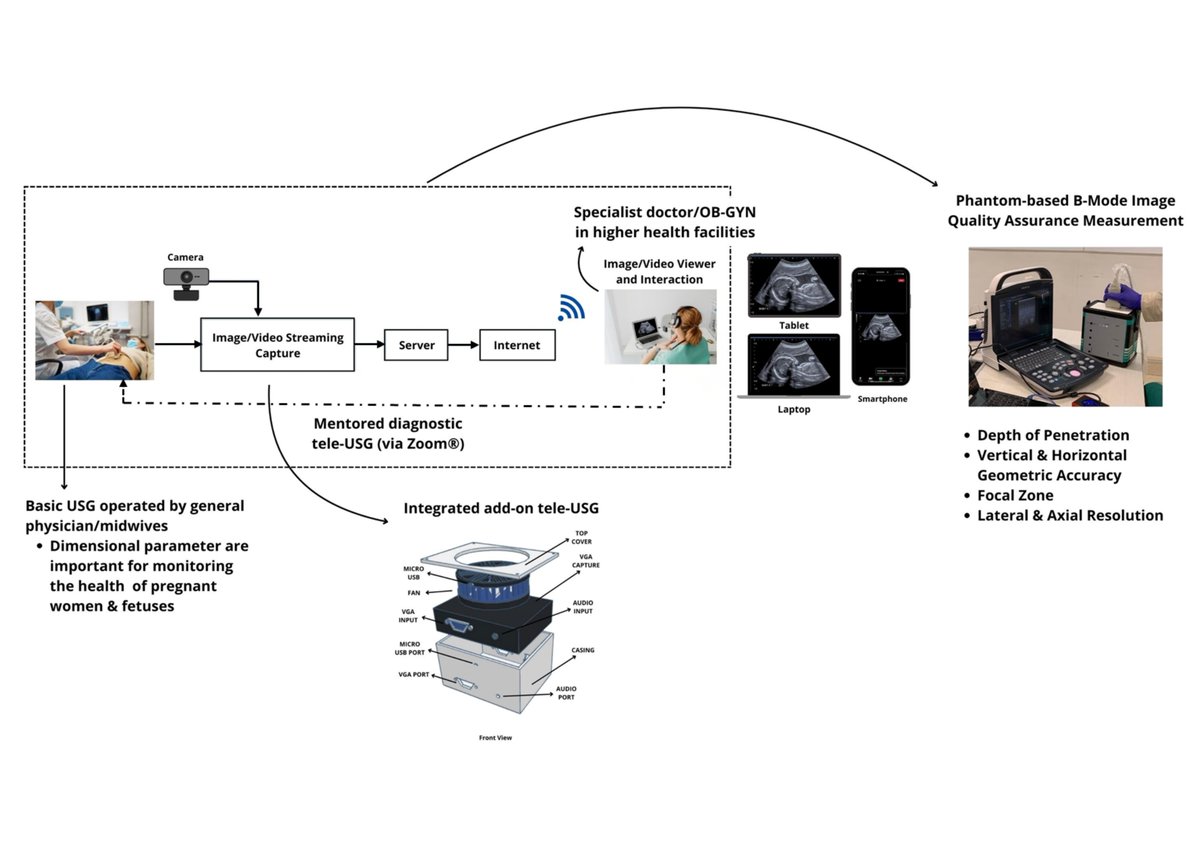 JEngTechSci's tweet image. The Initial Development of Integrated Add-On Tele-Ultrasonography for Monitoring the Health of Pregnant Women and Fetuses in the Community Health Centers in Indonesia

#Bmode #fetalgrowth #Phantom #telemedicine #teleUSG #ultrasonography

doi.org/10.5614/j.eng.…
