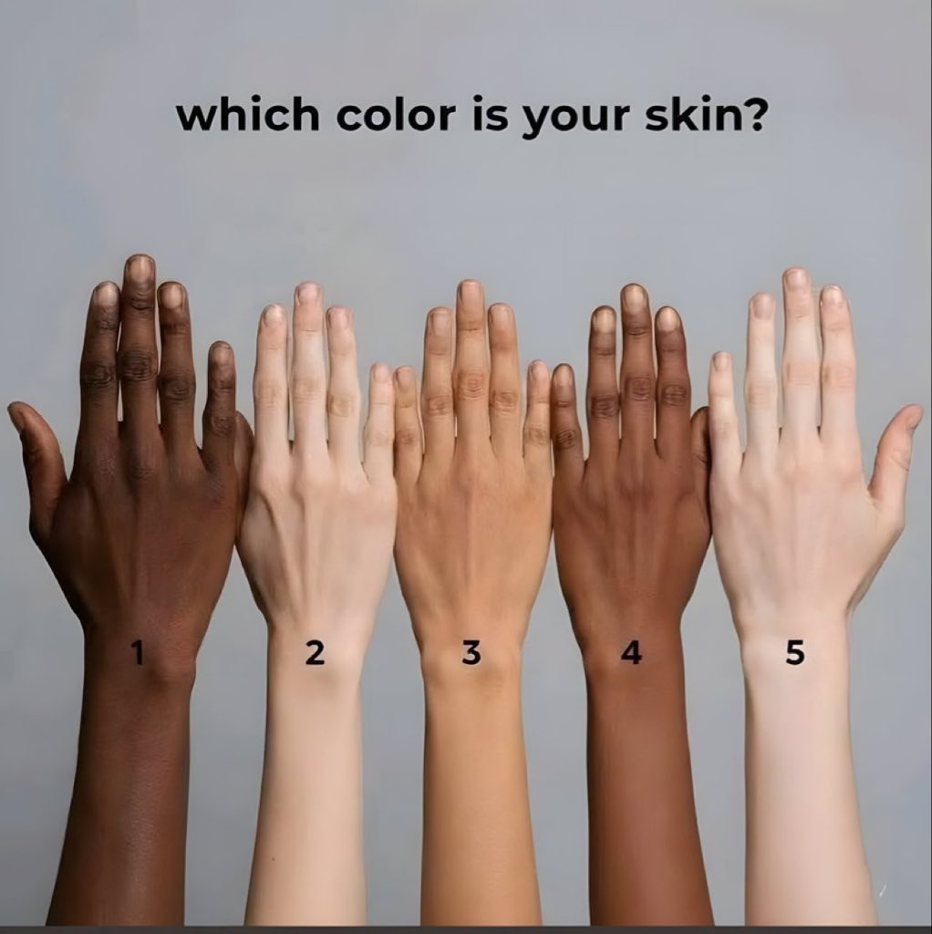 IamJoe_lOmiat's tweet image. Which color is your skin 😊