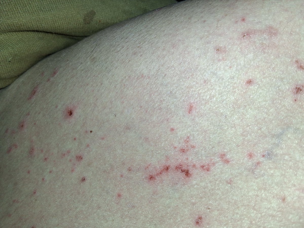 StackhouseDon's tweet image. I got Attacked 🪳🪳🪳🪳🪳 
🦂🦂🦂🦂🦂🦂🦂🦂🦂🦂🦂