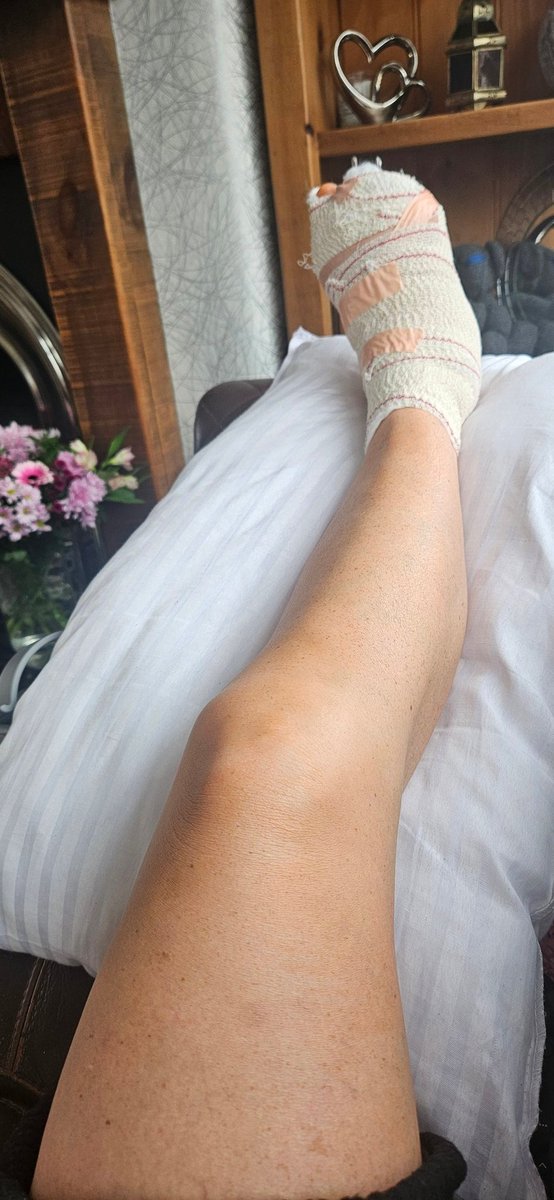 This year I have discovered that I have the rarer type of #EhlersDanlosSyndrome. I have a change in my COL5 A2. Currently resting from 1 of 2 feet operations. Despite multiple joint issues, dislocations, bleeding etc; I'll keep pushing myself to be the best I can <a href="/ehlersdanlosuk/">Ehlers-Danlos Support UK</a>