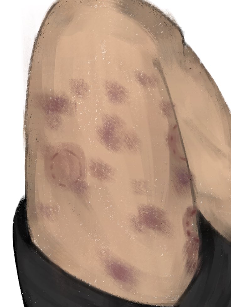 Psych0punktw1nk's tweet photo. Ho ho- holy shit heh..he REALLY did hold back hahah- hahhhhahah… my ass hurts
//@ViItrumsSoldier TW: suggestive
#mohawkwilliam #willmark #viltrumitemark #hickies #rendering #art https://t.co/Aq3mMexCpz