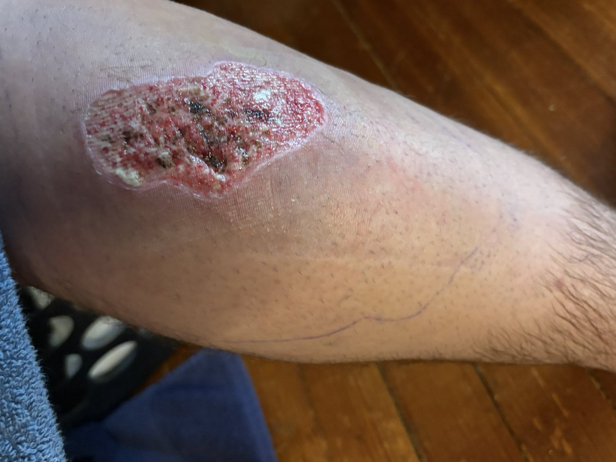 cjmow's tweet photo. Hi, I started this fundraiser, Bridge the Gap for a Family in Crisis, on GoFundMe and it would mean a lot to me if you’d be able to share or donate to it. https://t.co/XVjR4srCkW https://t.co/wsgvpDBrPK